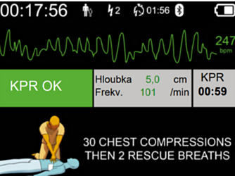 DefiSign Pocket Plus -laitteen EKG-näyttövaihtoehto  - 11527